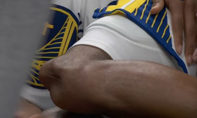 勇士球员穆迪接受左膝手术提前赛季报销